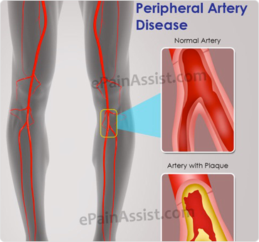 Capital Cardiovascular Specialists PLLC