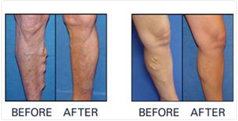 Capital Cardiovascular Specialists PLLC